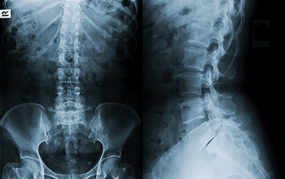 Spine and Extremity X-rays Everett, WA